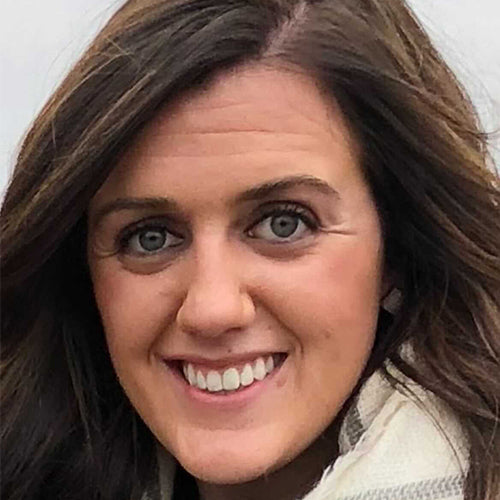 Woman with wrinkled forehead before using Frownies