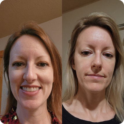 Gua_Sha_Before_and_After using rose quartz gua sha stone for facial massage to smooth wrinkles and sculpt jawline