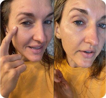 split photo of woman wearing yellow shirt pointing to crow's feet at corner of the eyes
